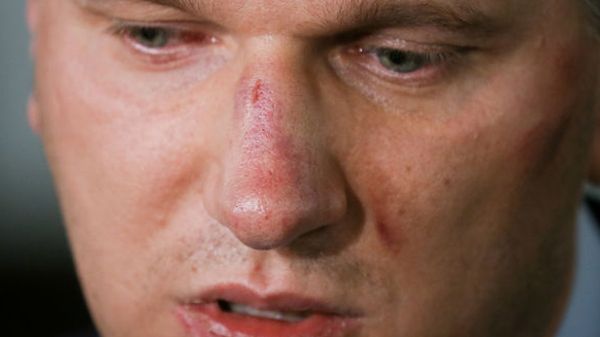 Przemysław Wipler utrzymuje, że został pobity przez policjantów