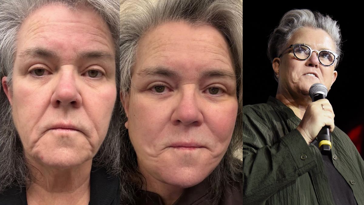 Rosie O'Donnell poddała się liftingowi twarzy