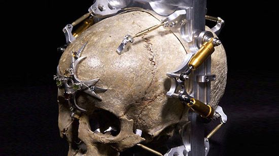 Co można zrobić ze 150-letniej ludzkiej czaszki? 1