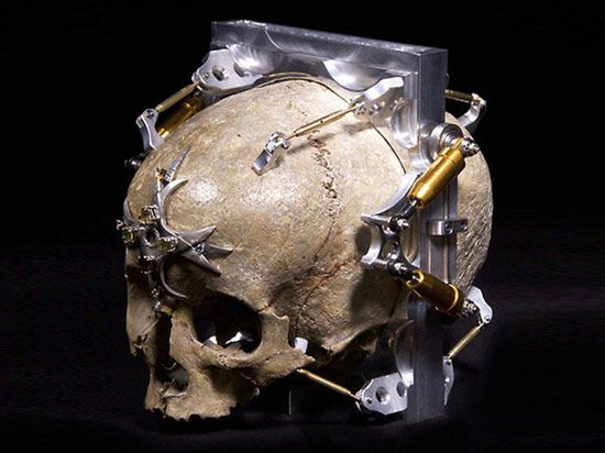 Co można zrobić ze 150-letniej ludzkiej czaszki?