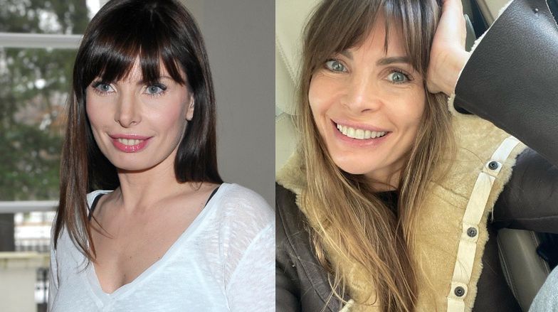 Najdroższe uśmiechy gwiazd