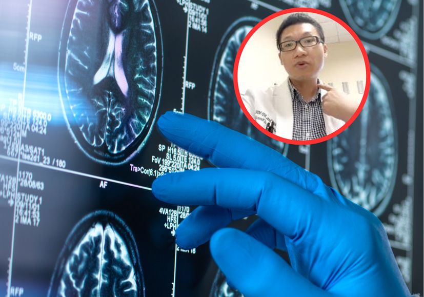 6 sposobów na obniżenie ryzyka demencji według neurologa