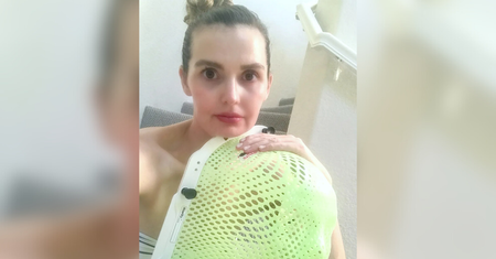 Mały guzek okazał się rakiem. Kobieta myślała, że po prostu ugryzła się w język