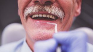 Stan zębów a choroba Alzheimera. Naukowcy odkryli zależność