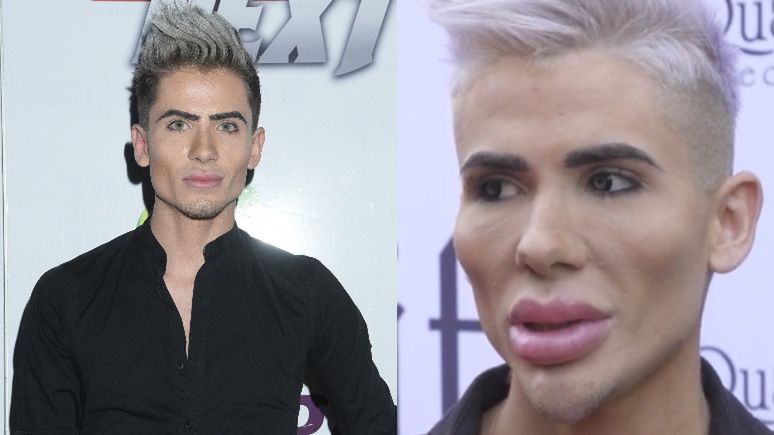 Michał Przybyłowicz planuje kolejne operacje plastyczne