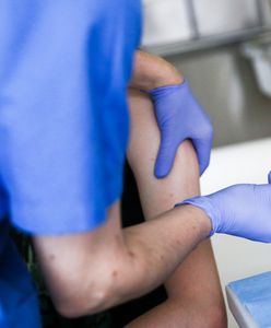 Chorzów. Zaskakujące oświadczenia: "Szczepienie jako eksperyment". Jest interwencja