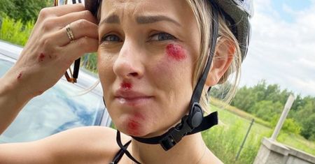 Znana trenerka fitness miała wypadek na rowerze. Jej historia jest przestrogą
