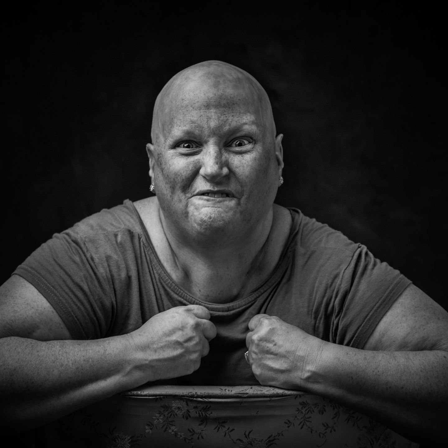 "Twarze raka" to projekt, który pokazuje prawdziwe oblicze choroby 15