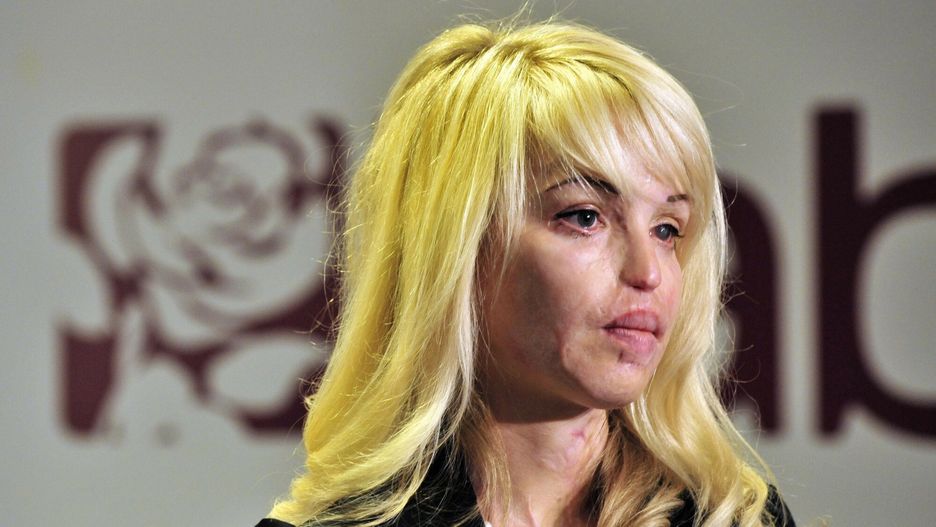 Przeszła ponad 400 operacji