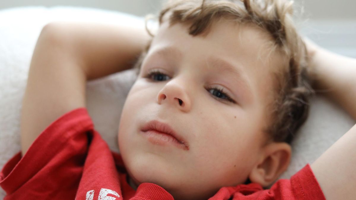 Opryszczka wargowa objawia się bolesnymi pęcherzykami na ustach