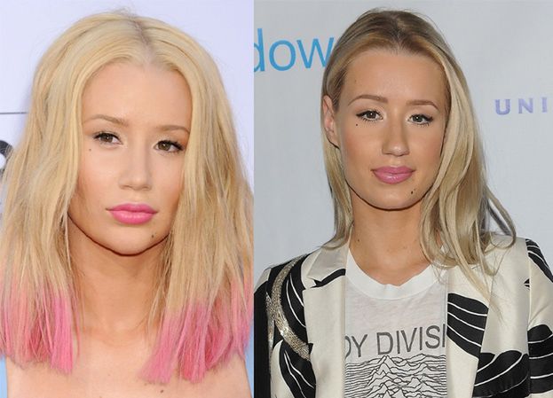 Iggy Azalea poprawiła nos i kształt brody? (ZDJĘCIA)