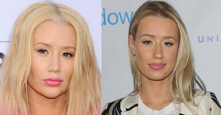 Iggy Azalea poprawiła nos i kształt brody? (ZDJĘCIA)