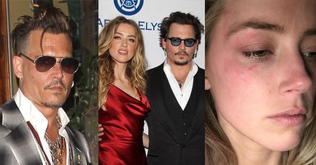 Johnny Depp usunął tatuaż, który zrobił dla Amber!
