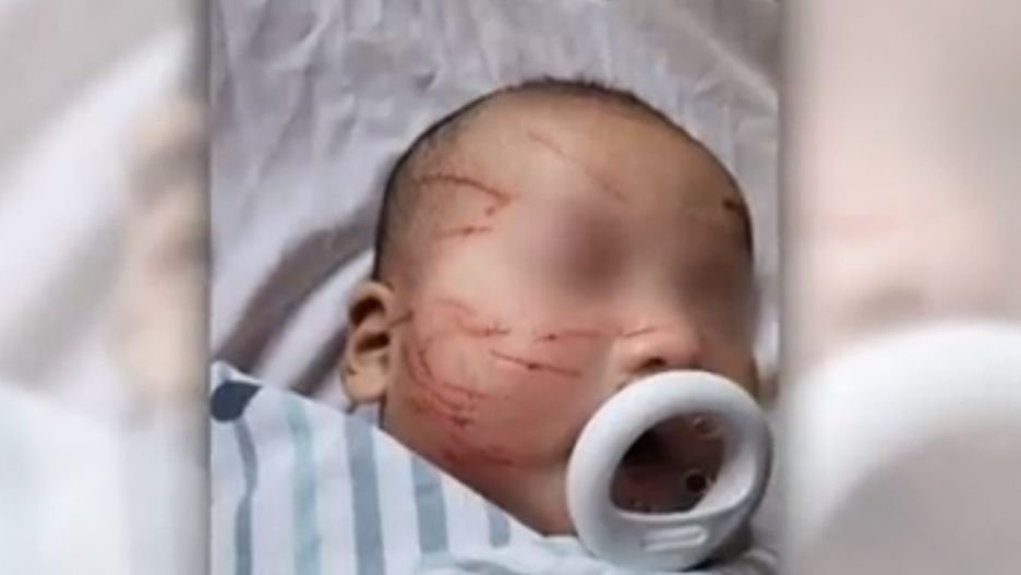 Zobaczyła zdjęcie ze żłobka i zamarła. Dziecko miało 20 szram na twarzy