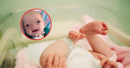 Chłopiec z Alabamy urodził się bez nosa. To bardzo rzadka wada