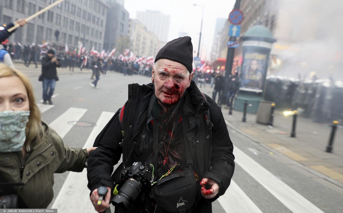 Marsz Niepodległości. Fotoreporter "Tygodnika Solidarność" Tomasz Gutry poważnie zraniony
