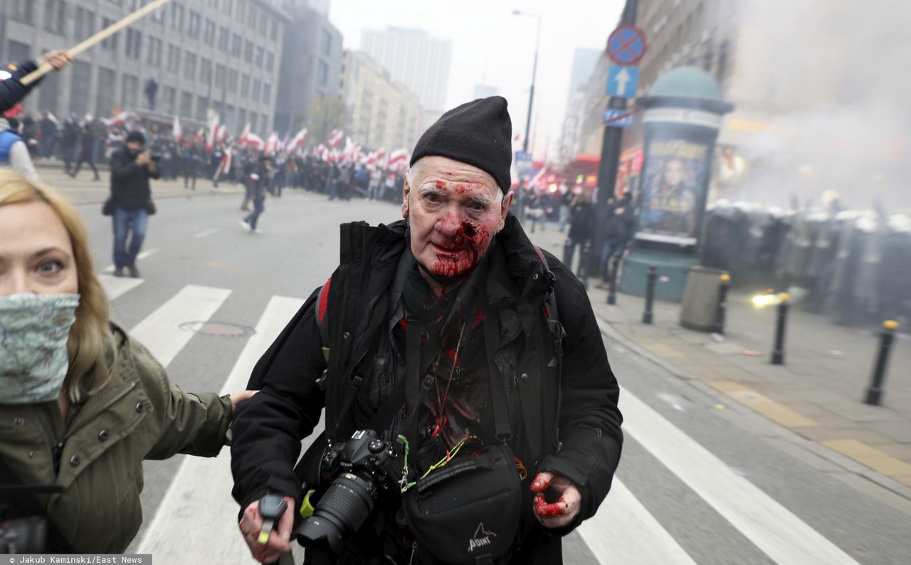 Marsz Niepodległości. Legendarny fotoreporter Tomasz Gutry poważnie zraniony