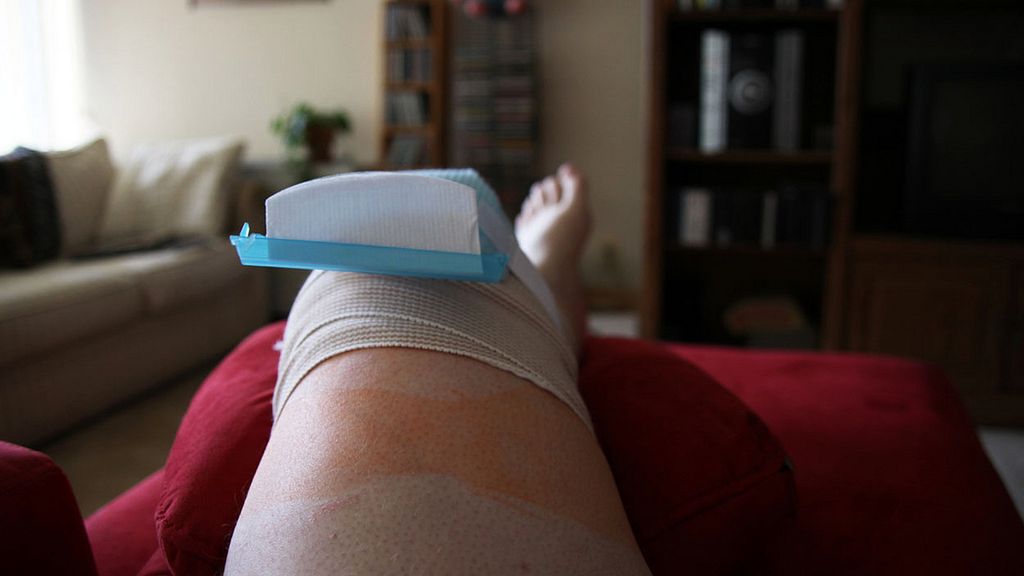 Ból stawów można złagodzić, unosząc bolącą nogę 