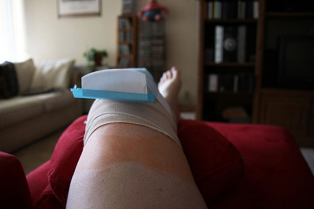 Ból stawów. Na jakie schorzenia może wskazywać?