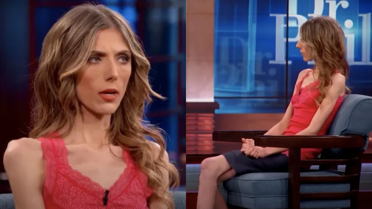 Jordan ważyła tylko 34 kilogramy. Dziś wygląda jak inna osoba