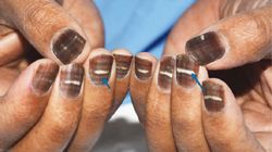 Nietypowe skutki chemioterapii. Pacjent z brązowymi paznokciami