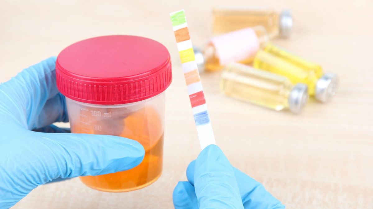 Ph moczu – badanie, wyniki, nieprawidłowości