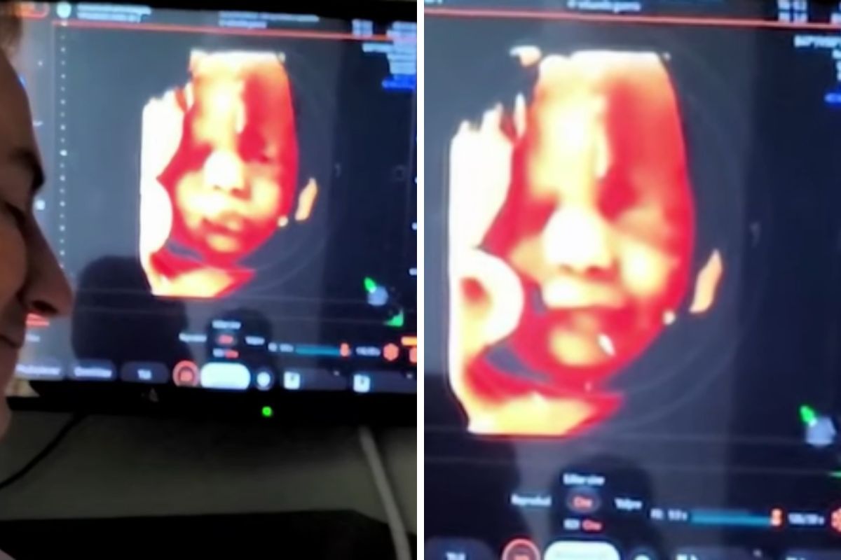 Nienarodzone dziecko uśmiecha się na dźwięk głosu swojego taty