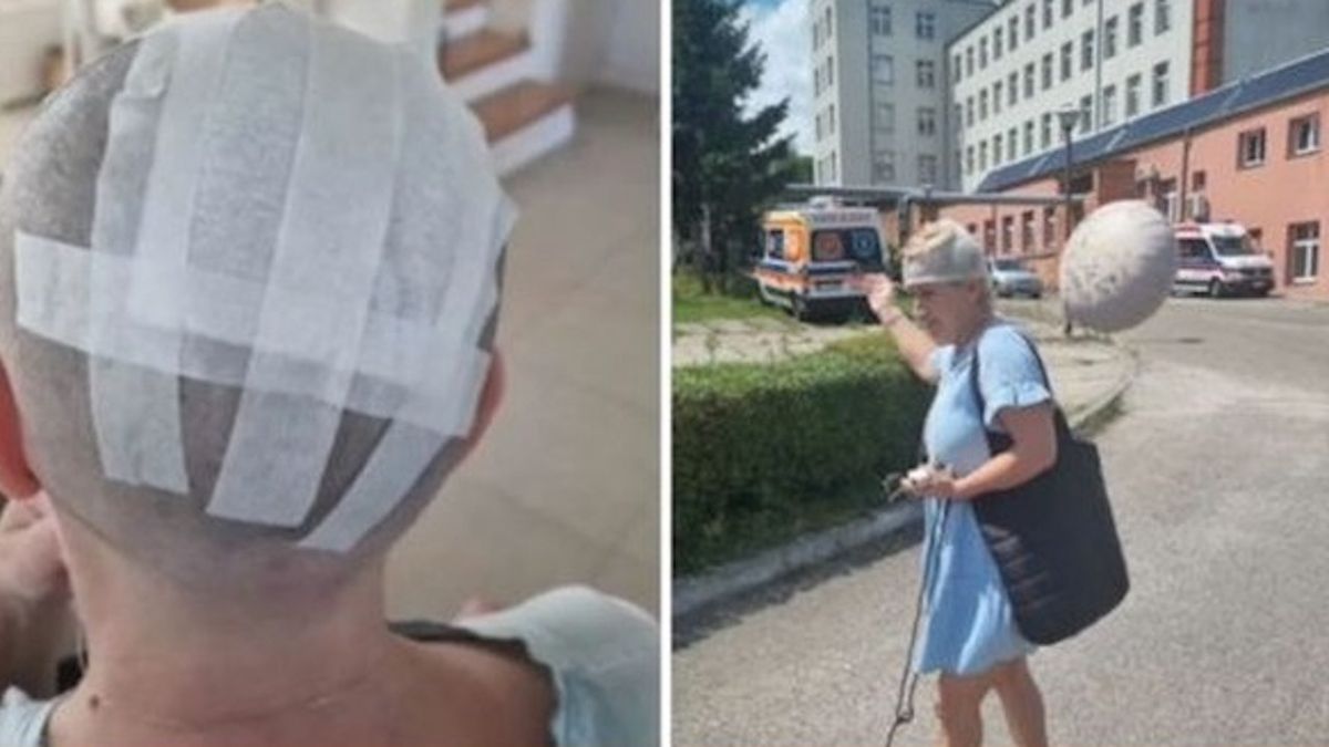 Upuścił piłę spalinową na głowę kobiety. Urząd Miasta unika odpowiedzialności