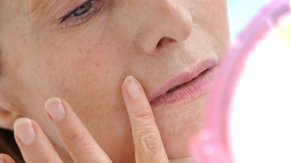 "Domowy botoks" na zmarszczki