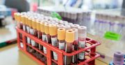 Radom: Akcja zbiórki krwi w Zespole Szkół Samochodowych. Zgłosiło się blisko 50 dawców