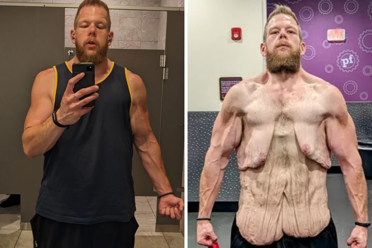 Schudł ponad 160 kg