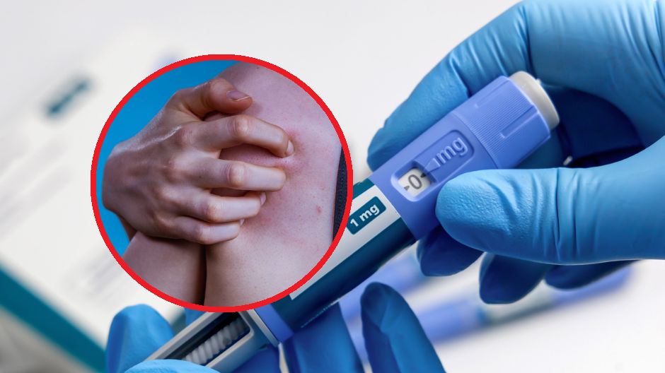 Allodynia to mało znane schorzenie