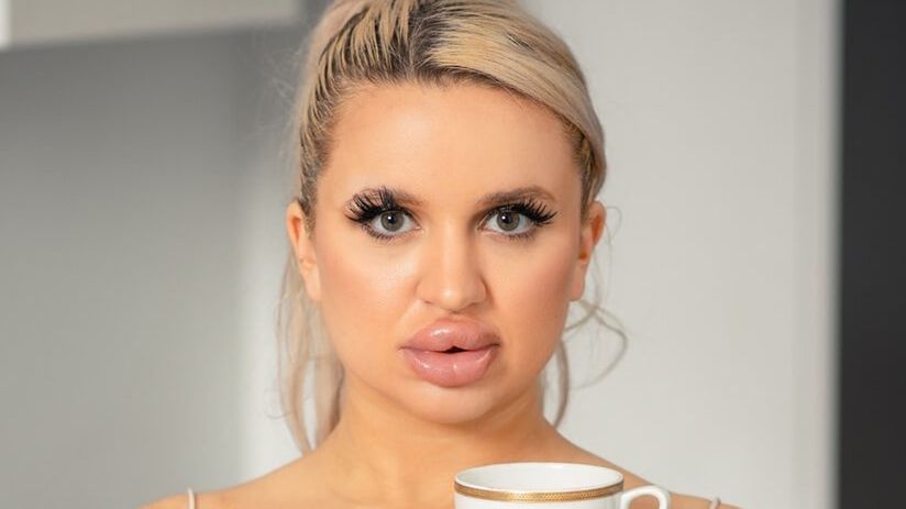 Jessy Bunny po operacji plastycznej