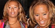 Co się stało z twarzą Mel B?! (FOTO)
