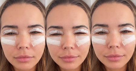 Sandra Kubicka dokumentuje czwarty dzień po operacji powiek: "ZACZYNAM RUSZAĆ OCZAMI" (FOTO)