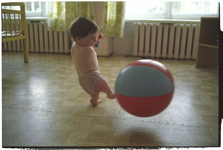 Niepełnosprawne dziecko urodzone po katastrofie w Czarnobylu. Rok 1988.