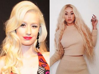 Iggy Azalea znów majstrowała przy twarzy: "Jesteś dziełem chirurga plastycznego" (FOTO)