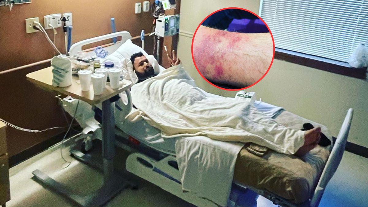 Muzyka ukąsił jadowity pająk