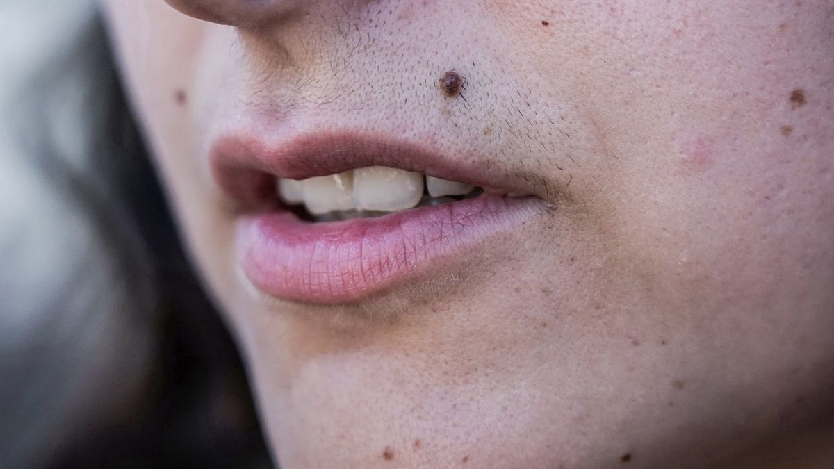 Jak się pozbyć damskiego wąsika?