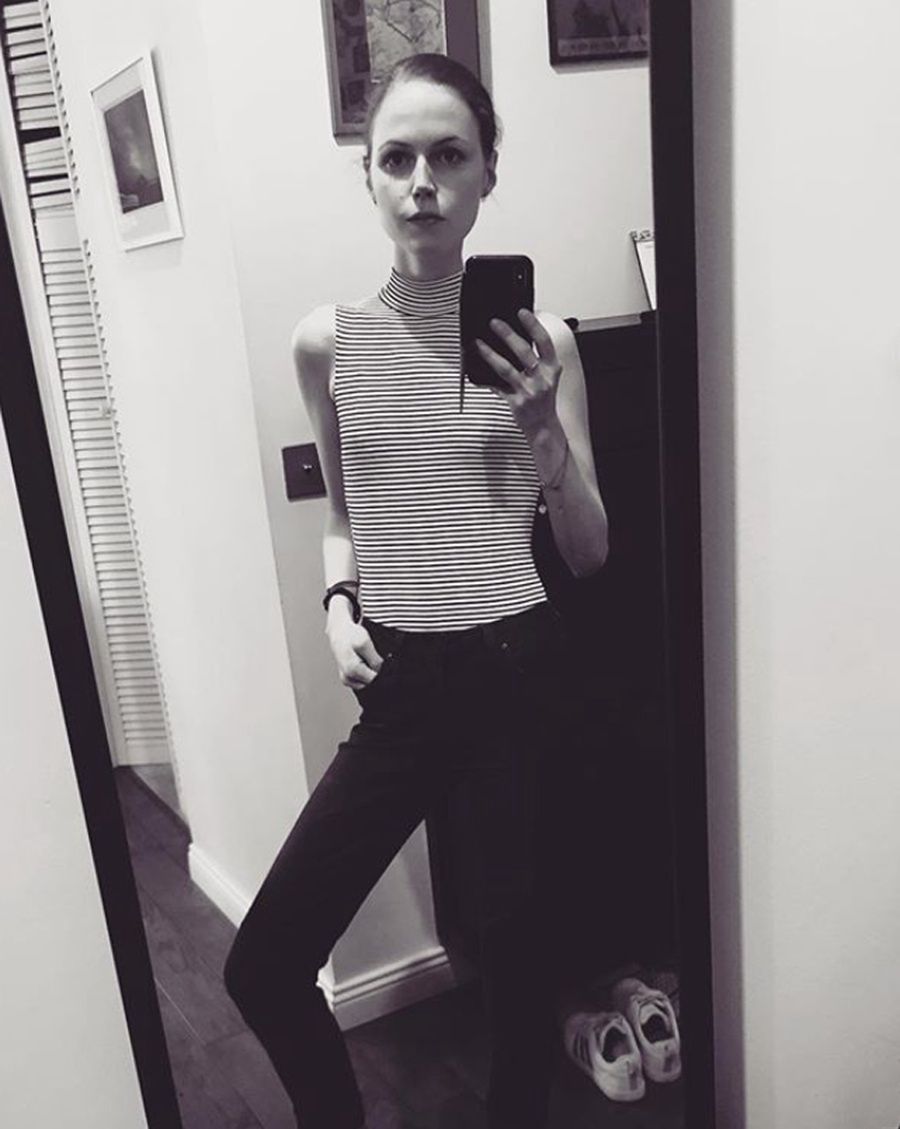 Patrycja Volny walczy z anoreksją