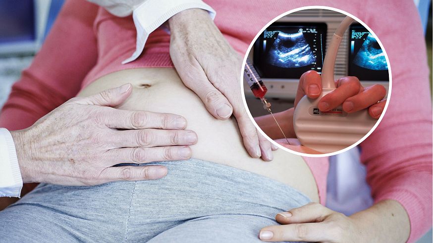 Badania obrazowe skuteczne w wykrywaniu stłuszczenia wątroby