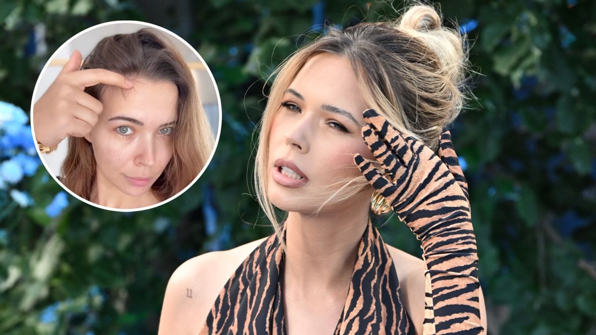 Sandra Kubicka narzeka na wypadanie włosów