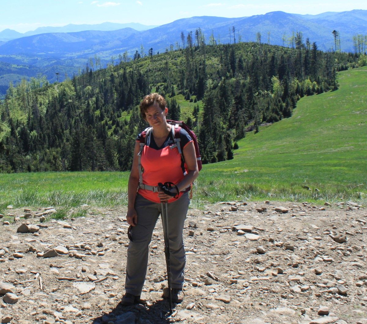 Katarzyna Kuźnik-Krygier choruje na łuszczycę od 20 lat 