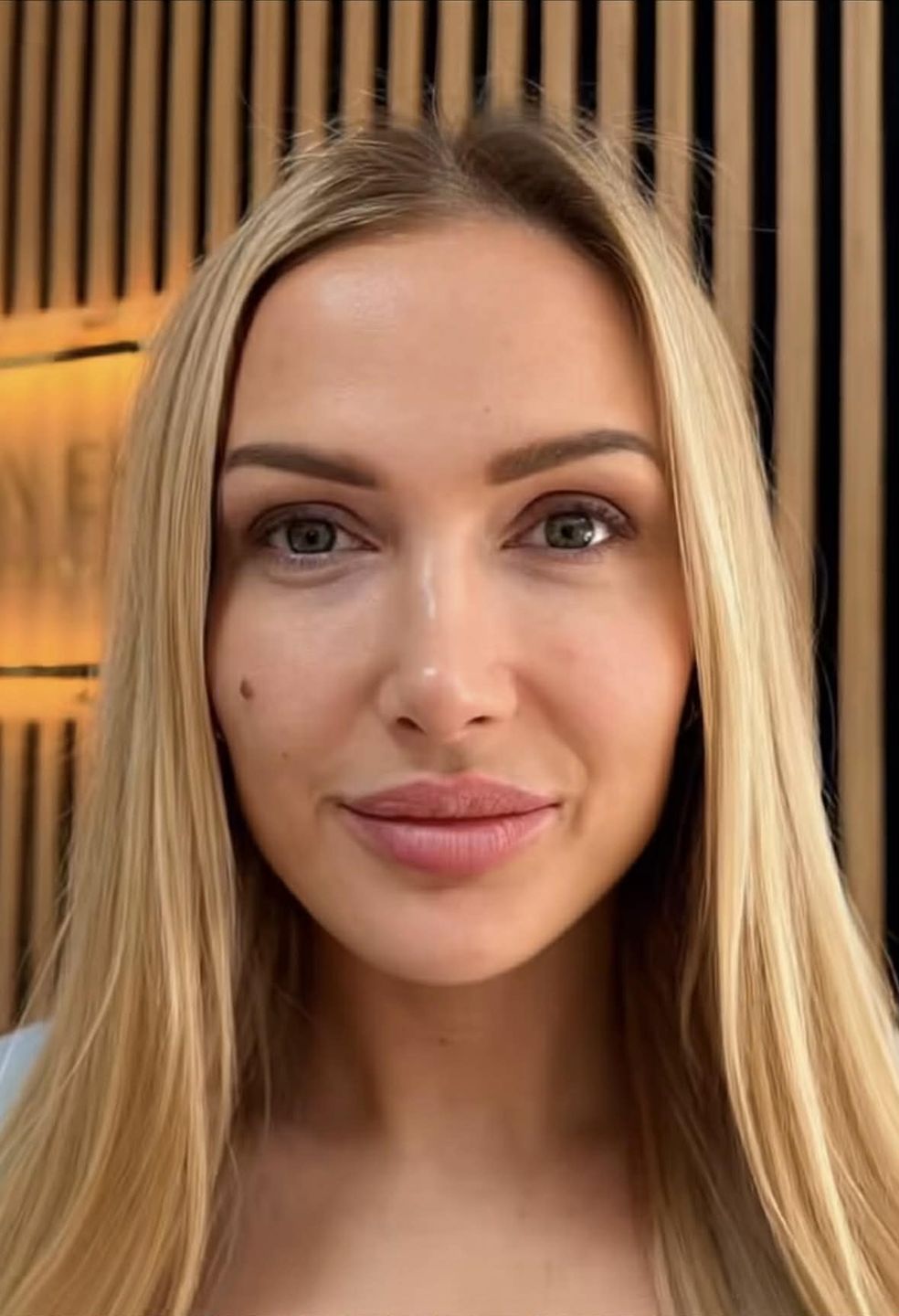 Eliza Trybała relacjonuje wizytę w klinice