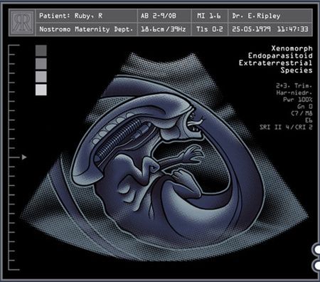 Koszulka z ultrasonografem kosmity! 2
