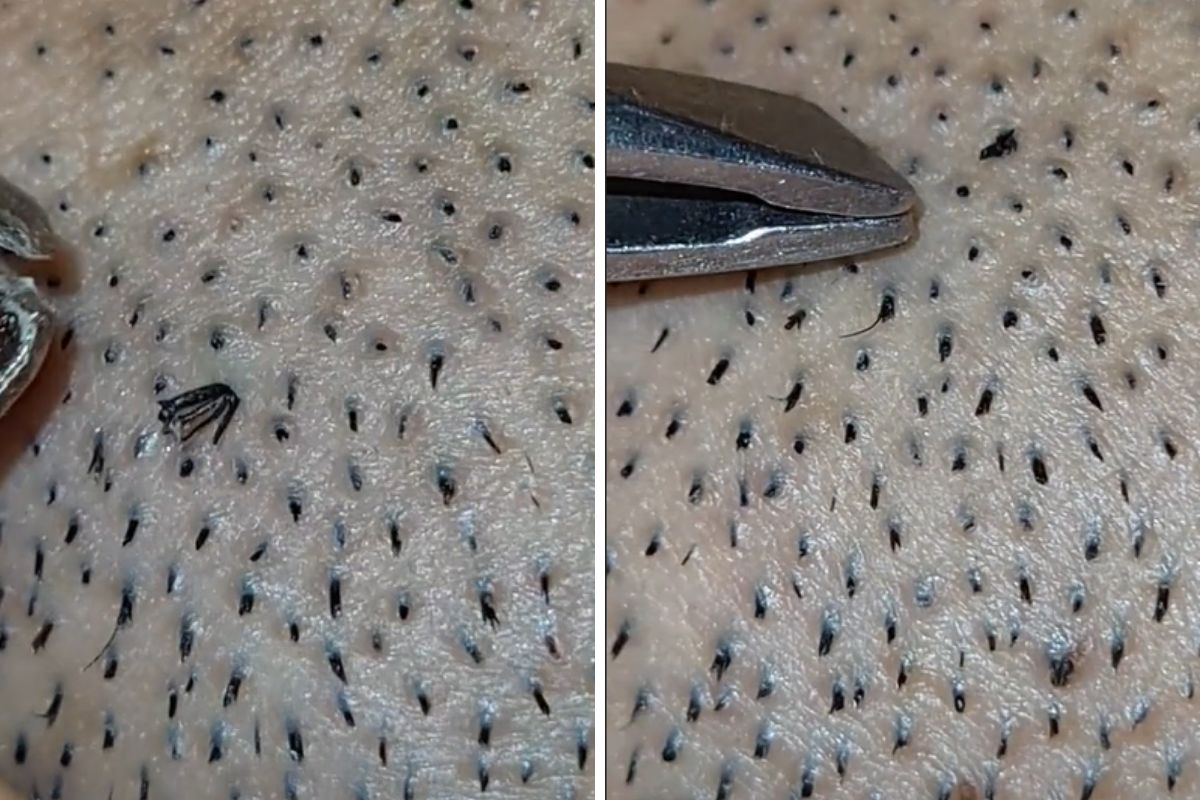 Na filmie widać, jak kobieta wyrywa wrastające włoski z brody swojego partnera