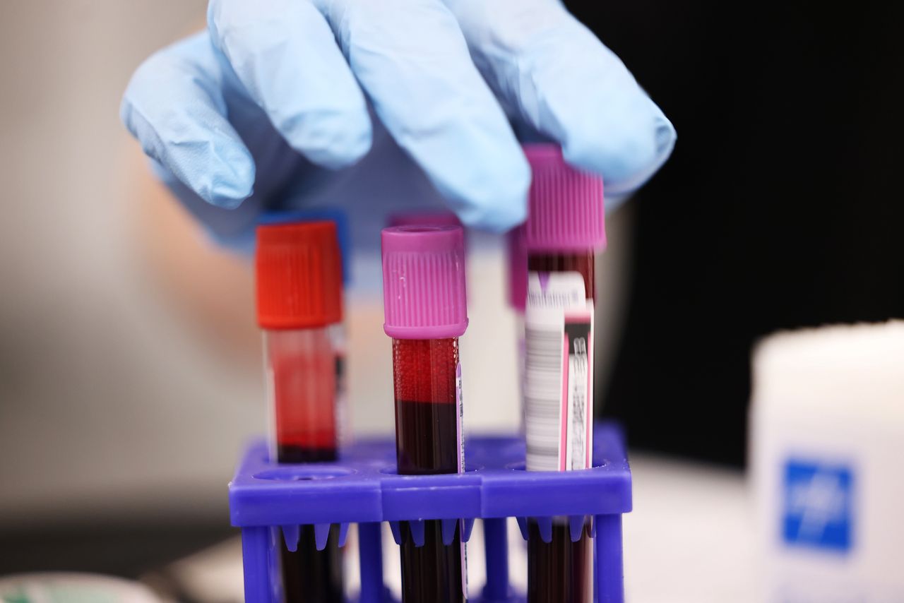 Odkryli ją po 50 latach. Naukowcy znaleźli nową grupę krwi