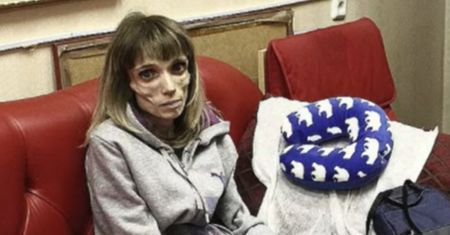 Kiedyś ważyła tylko 17 kg i nie mogła wstać z łóżka. Tak wygląda dziś