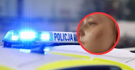 Dzieci z Ukrainy pobite w Legnicy? Pokazała zdjęcia córki