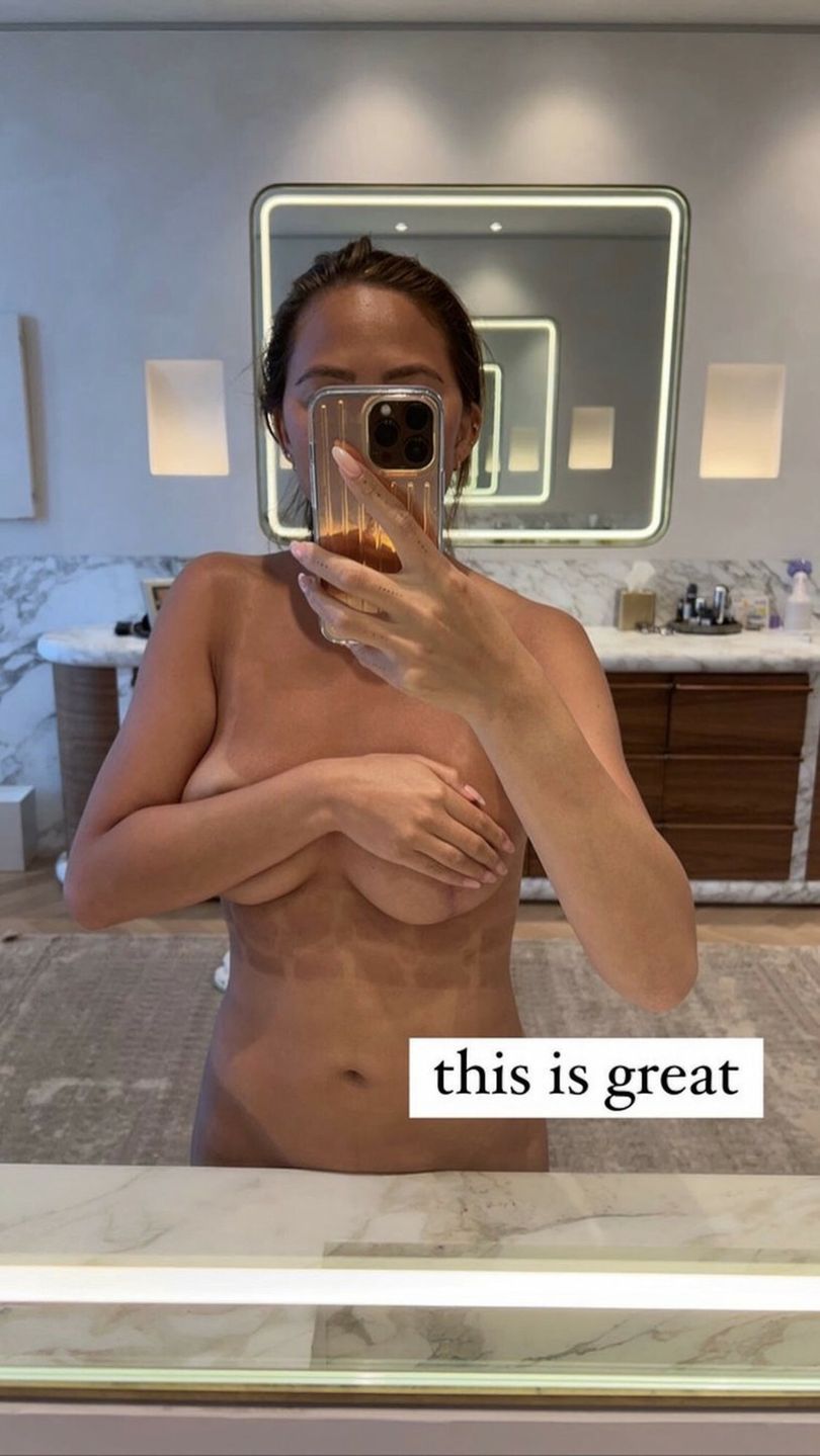Chrissy Teigen nago